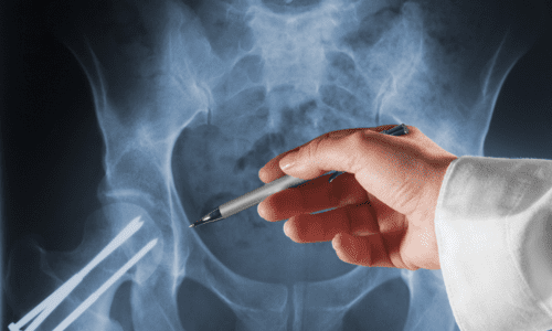 en hand som håller i en penna