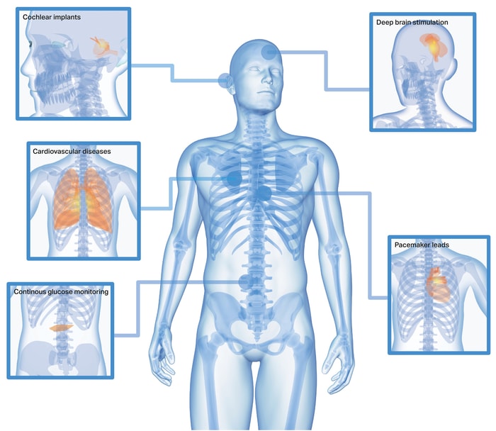 a person with multiple images of the body